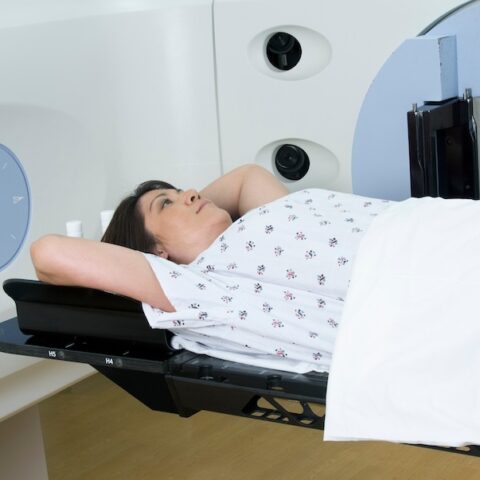 Woman Receiving Radiation Therapy Treatments for Lung Cancer
